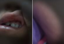 Pais são presos em flagrante por maus-tratos a criança de 3 anos encontrada com hematomas pelo corpo em Tanabi