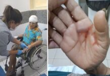 Idosa de 67 anos é atacada por pitbull em Pereira Barreto