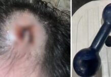 Personal trainer desmaia após ser golpeado na cabeça com peso de academia por aluno Jales