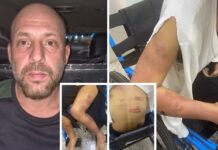 Mulher sequestrada, torturada e mantida em cárcere durante 4 dias já tinha sido agredida e acreditou que namorado iria mudar, diz delegado