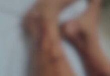 Pitbull escapa de residência e ataca criança em Fernandópolis