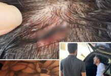 Homem é preso suspeito de morder e arrancar dedo de mulher em Auriflama