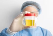 Xixi escuro ou com cheiro? Quando a urina pode ser um sinal de alerta para a saúde dos rins