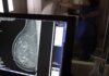 SUS passa a oferecer mamografia para mulheres a partir de 40 anos