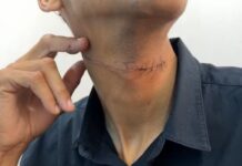 Motociclista fica ferido ao ser atingido por linha chilena em Votuporanga