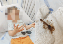 Criança é picada por escorpião em creche de Votuporanga