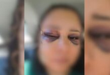 Mulher tem fratura no nariz e no maxilar após ser espancada por homem dentro de apartamento em Rio Preto