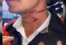 Fio pendurado deixa mais um motociclista ferido em Votuporanga