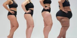 Entre tecidos: a gordura que dói