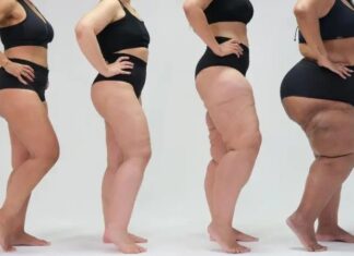 Entre tecidos: a gordura que dói