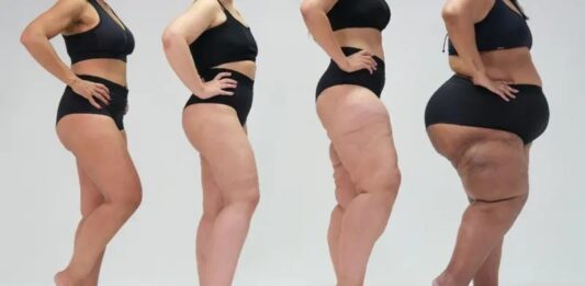 Entre tecidos: a gordura que dói