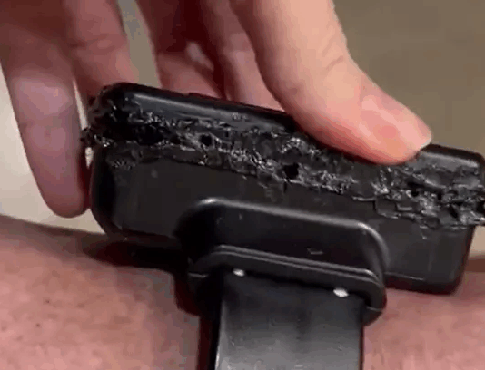 Eduardo Bolsonaro comenta prisão do pai e violação em tornozeleira: ‘Talvez possa ter surtado’