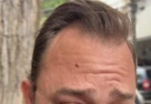 Dr. Hery aciona o Ministério Público contra alta no valor da água em Votuporanga