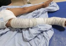 Criança de 5 anos é atropelada por motociclista que fugiu sem prestar socorro em Ilha Solteira