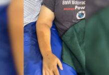 Mulher é picada por cobra jararaca enquanto colhia abóboras em sítio