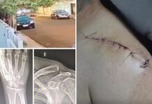 Motociclista fica gravemente ferido após enroscar em fiação solta em Votuporanga