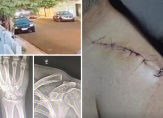 Motociclista fica gravemente ferido após enroscar em fiação solta em Votuporanga