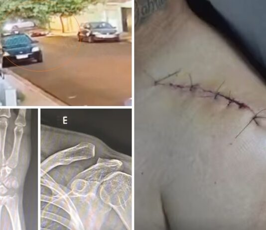 Motociclista fica gravemente ferido após enroscar em fiação solta em Votuporanga