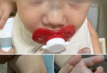 Bebê de 1 ano volta da creche com hematomas e fratura no nariz em Valentim Gentil