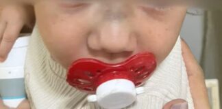 Bebê de 1 ano volta da creche com hematomas e fratura no nariz em Valentim Gentil