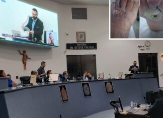 Críticas à saúde pautam sessão e vereadores miram reunião com secretária