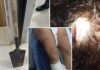 Mulher tem dedo quebrado e sofre cortes na cabeça após ser agredida com pá